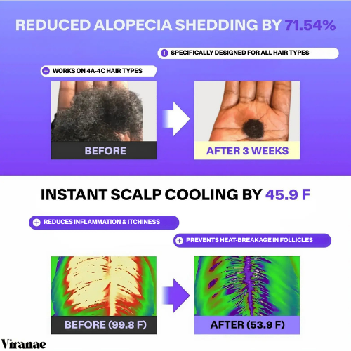 Roll-On Hairline Regrowth Ampoule Serum