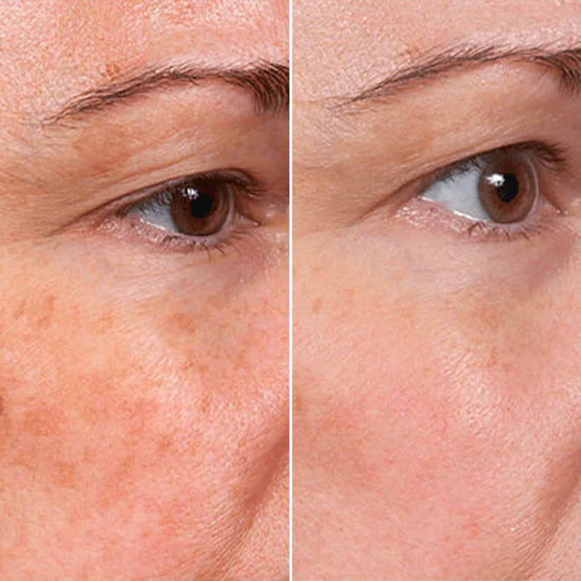 Viranae Rejuvenate Face Serum™