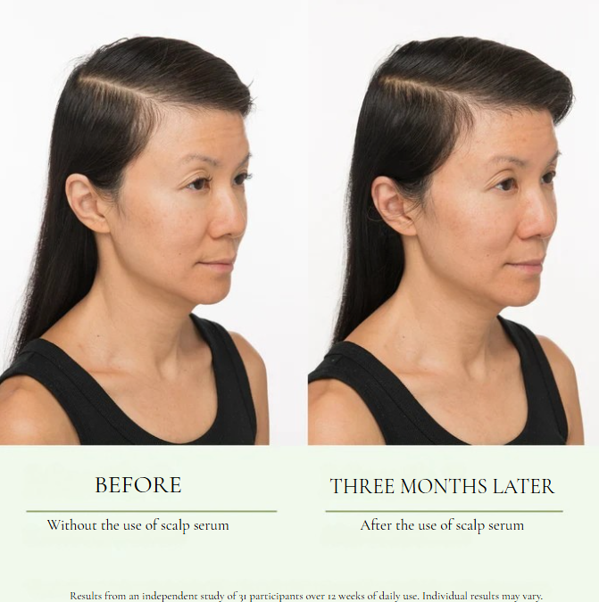 Viranae Scalp Serum