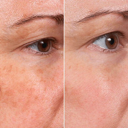 Viranae Rejuvenate Face Serum™